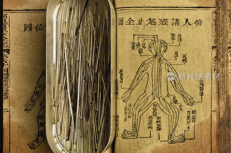 acupuncture needle